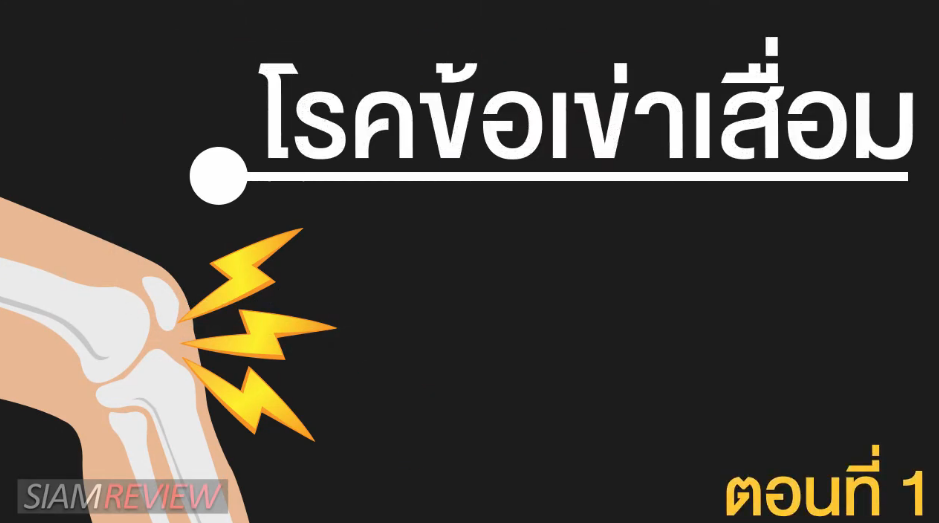  พบอาจารย์หมอกระดูกธรรมศาสตร์: โรคข้อเข่าเสื่อม คืออะไร