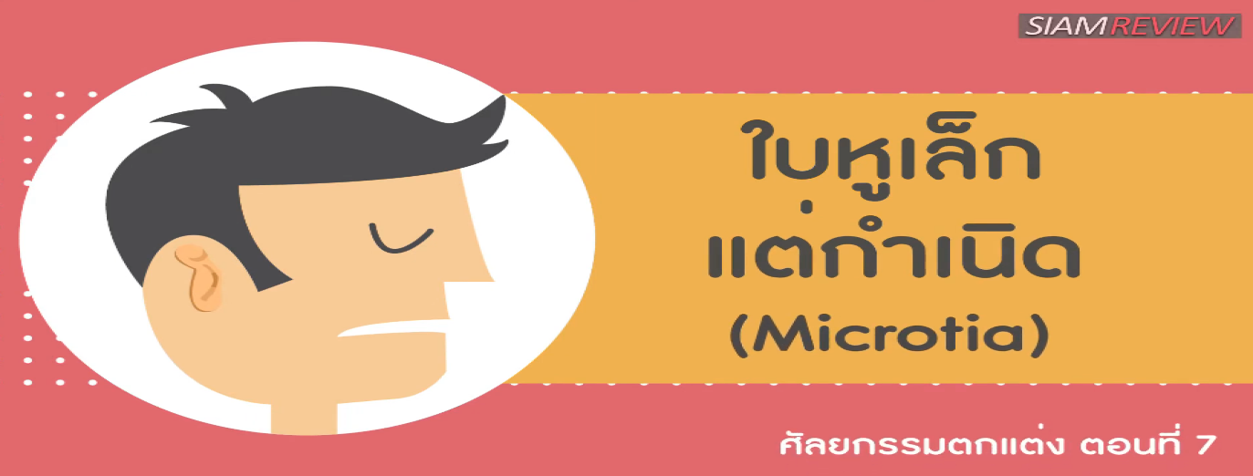 รูปประกอบ พบอาจารย์หมอศัลยกรรมตกแต่งจุฬา ตอนที่ 7: ใบหูเล็กแต่กำเนิด