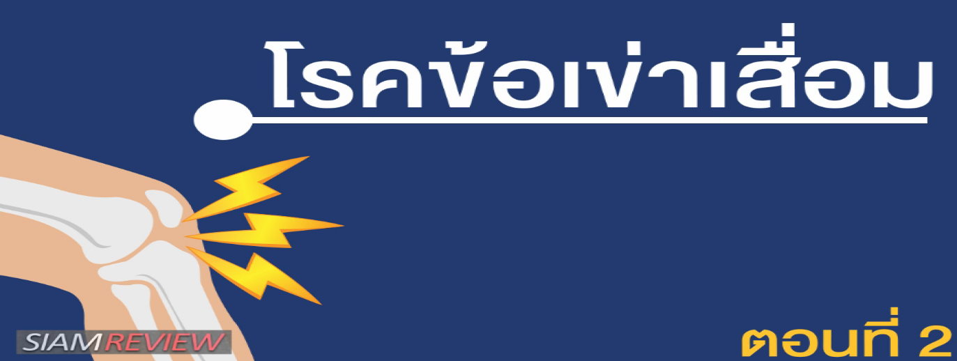 รูปประกอบ พบอาจารย์หมอกระดูกธรรมศาสตร์: ตอนที่ 2 วิธีการรักษาโรคข้อเข้าเสื่อม