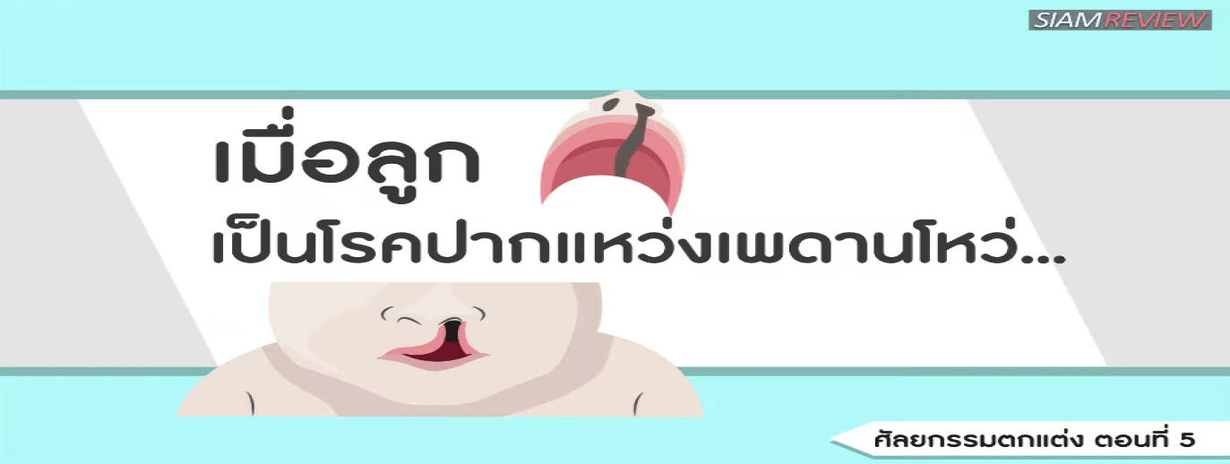 รูปประกอบ พบอาจารย์หมอศัลยกรรมตกแต่งจุฬา ตอนที่ 5: เมื่อลูกเป็นโรคปากแหว่ง เพดานโหว่