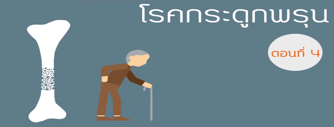 รูปประกอบพบอาจารย์หมอกระดูกธรรมศาสตร์ ตอนที่ 4: กระดูกหักจากโรคกระดูกพรุน