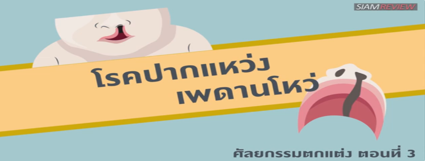 รูปประกอบ พบอาจารย์หมอศัลยกรรมตกแต่งจุฬา ตอนที่ 3: โรคปากแหว่ง เพดานโหว่