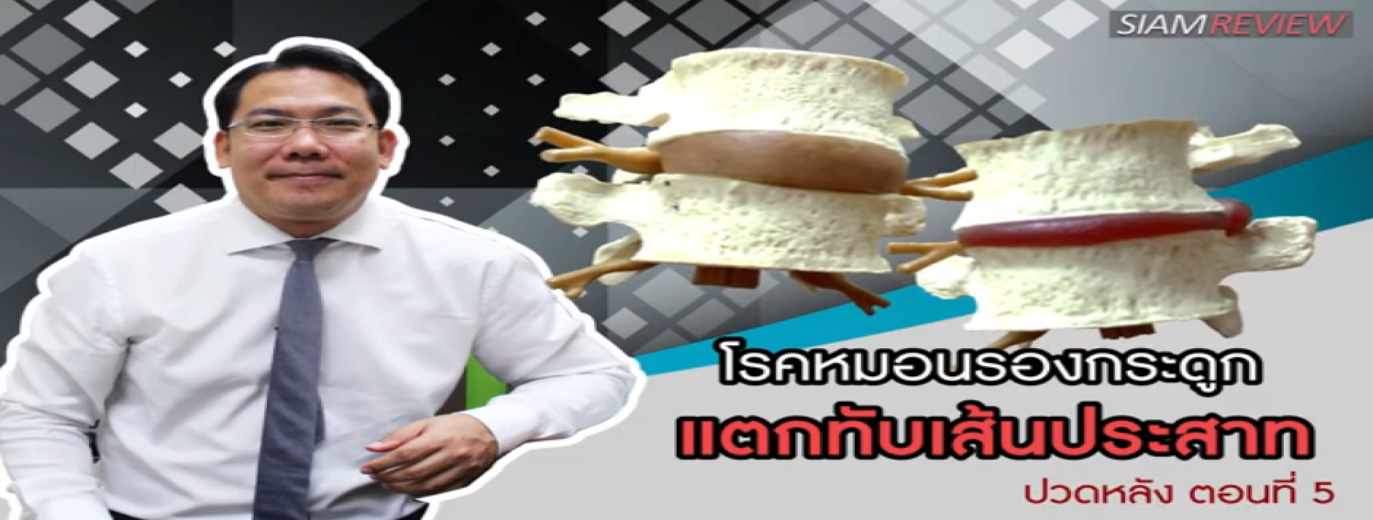 รูปประกอบพบอาจารย์หมอกระดูกธรรมศาสตร์ ปวดหลัง ตอนที่ 5: โรคหมอนรองกระดูกแตกทับเส้นประสาท