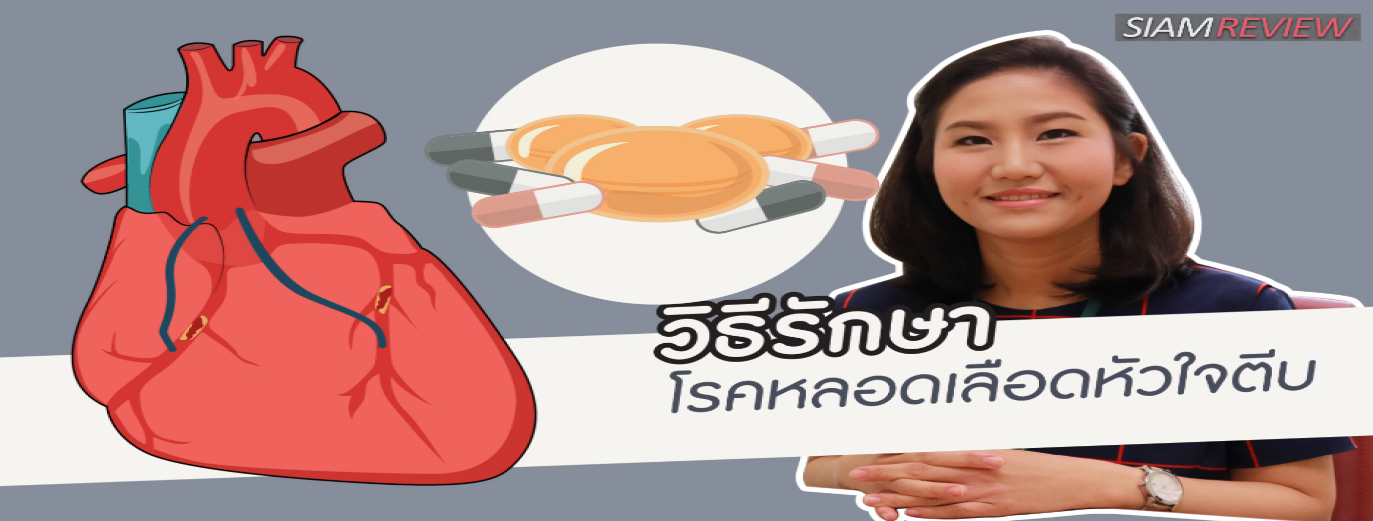 รูปประกอบ หลอดเลือดหัวใจ ตอนที่ 5: วิธีรักษาโรคหลอดเลือดหัวใจตีบ