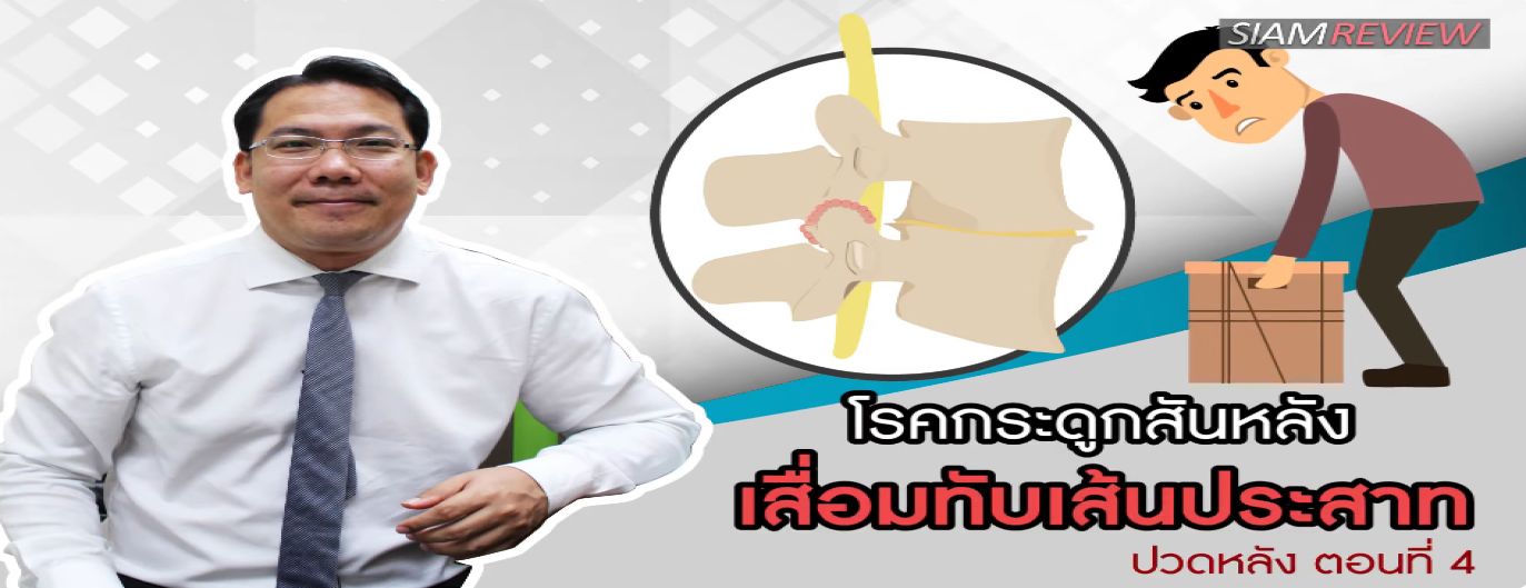 รูปประกอบ พบอาจารย์หมอกระดูกธรรมศาสตร์ ปวดหลัง ตอนที่ 4: โรคกระดูกสันหลังเสื่อมทับเส้นประสาท