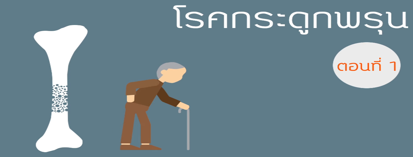 รูปประกอบ พบอาจารย์หมอกระดูกธรรมศาสตร์ ตอนที่ 1 นิยามของโรคกระดูกพรุน / ผู้ป่วยกลุ่มเสี่ยง